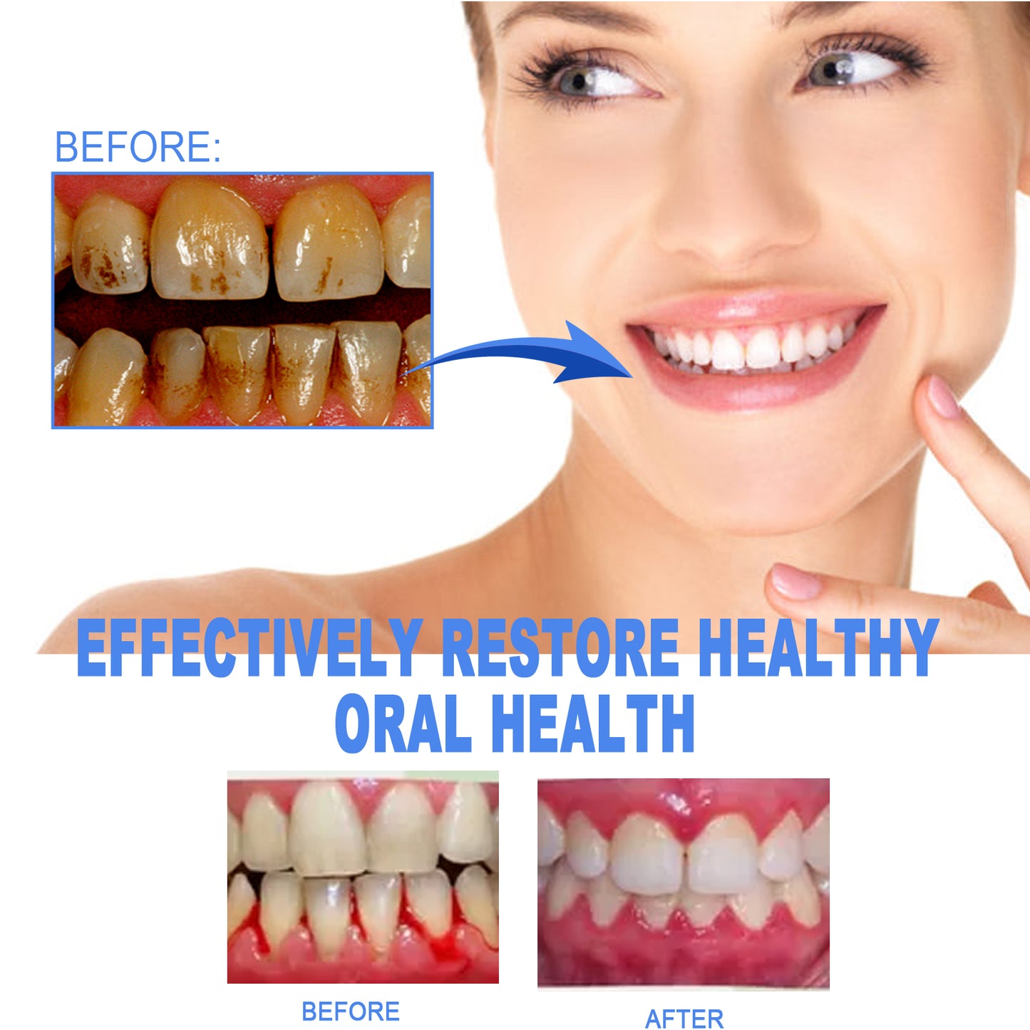 Hebeluxe Dental Repair Gel, Repair Gums Cleaning Dental Stains And Tartar Oral Care Gel